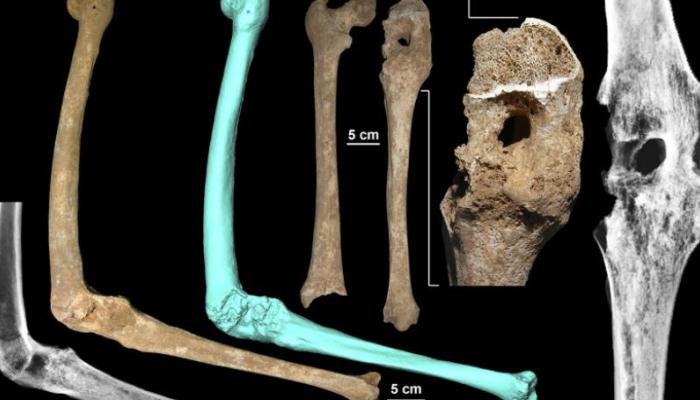 Μέγας Αλέξανδρος: Ο τάφος με την πανοπλία του λύνει οριστικά το μυστήριο της Βεργίνας