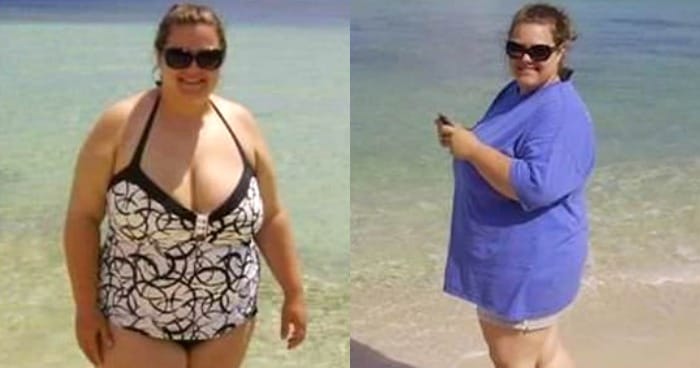 Παχυσαρκία: Ακόμα και λίγα παραπανίσια κιλά προκαλούν χρόνιες παθήσεις - latiendadeldesvan.es