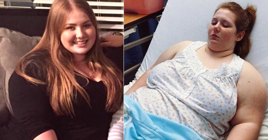 Υπέρβαρη 18χρονη αποφασίζει να αδυνατίσει, χάνει 50 κιλά και γίνεται διάσημη στο Instagram