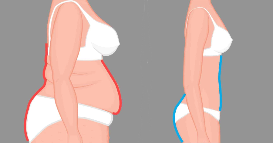 8 τρόποι για να χάσετε το λίπος της κοιλιάς και να μεταμορφώσετε το σώμα σας | iTrofi