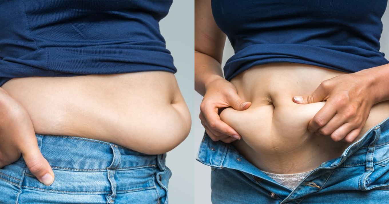 διαδικασίες αφαίρεσης λίπους στην κοιλιά δίαιτα για απώλεια βάρους με ανανά
