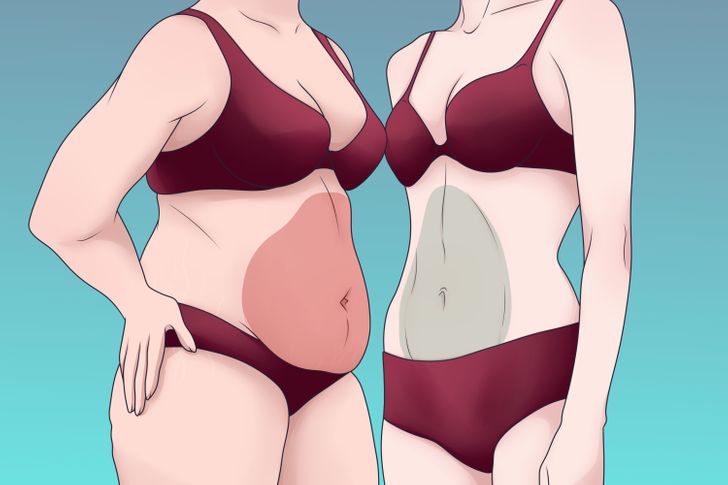 πώς να χάσετε το λίπος στην κοιλιά μετά την έκτρωση