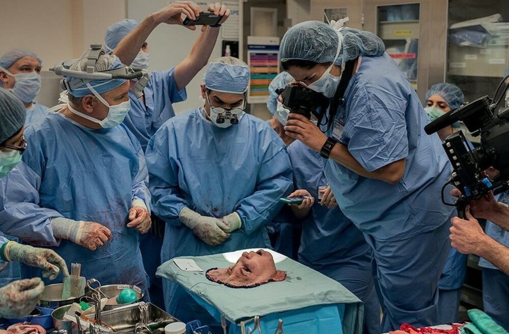 Το πρόσωπο που περιμένει τη μεταμόσχευσή του: Η φωτογραφία από το  χειρουργείο για 1η φορά στη δημοσιότητα