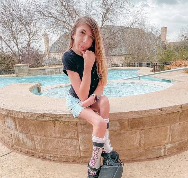 έχει υποβληθεί σε 33 χειρουργικές επεμβάσεις λόγω του ότι πάσχει από μια σπάνια πάθηση