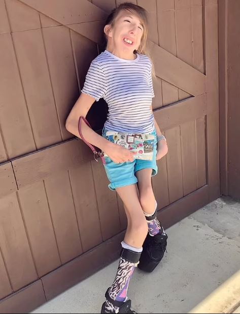 σπάνια πάθηση στις αρθρώσεις