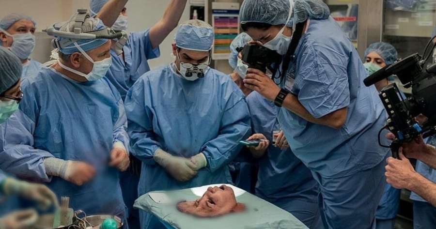 Μεταμόσχευση προσώπου: Φωτογραφία μέσα από το χειρουργείο.