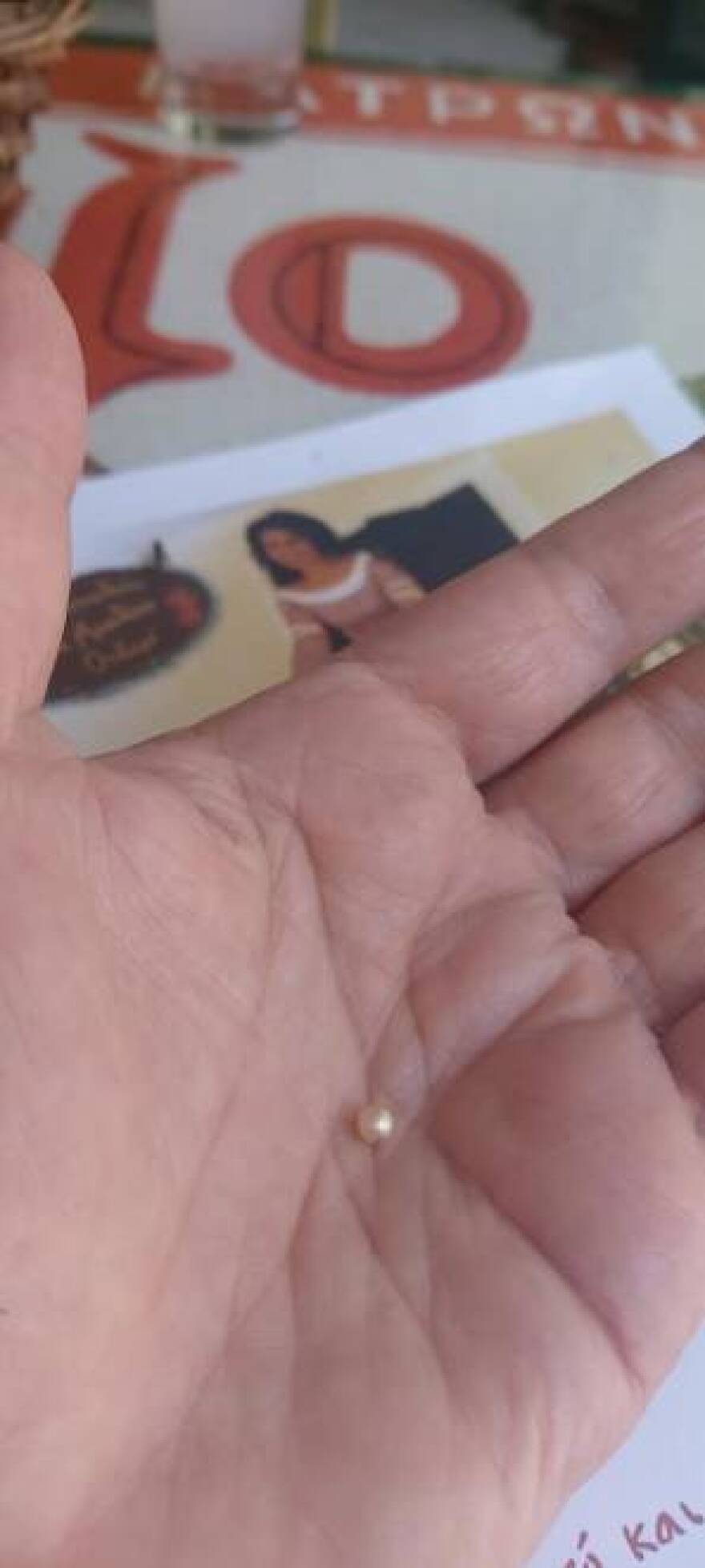 Ιδιοκτήτρια μεζεδοπωλείου στην Πάτρα βρήκε μαργαριτάρι σε στρείδι 