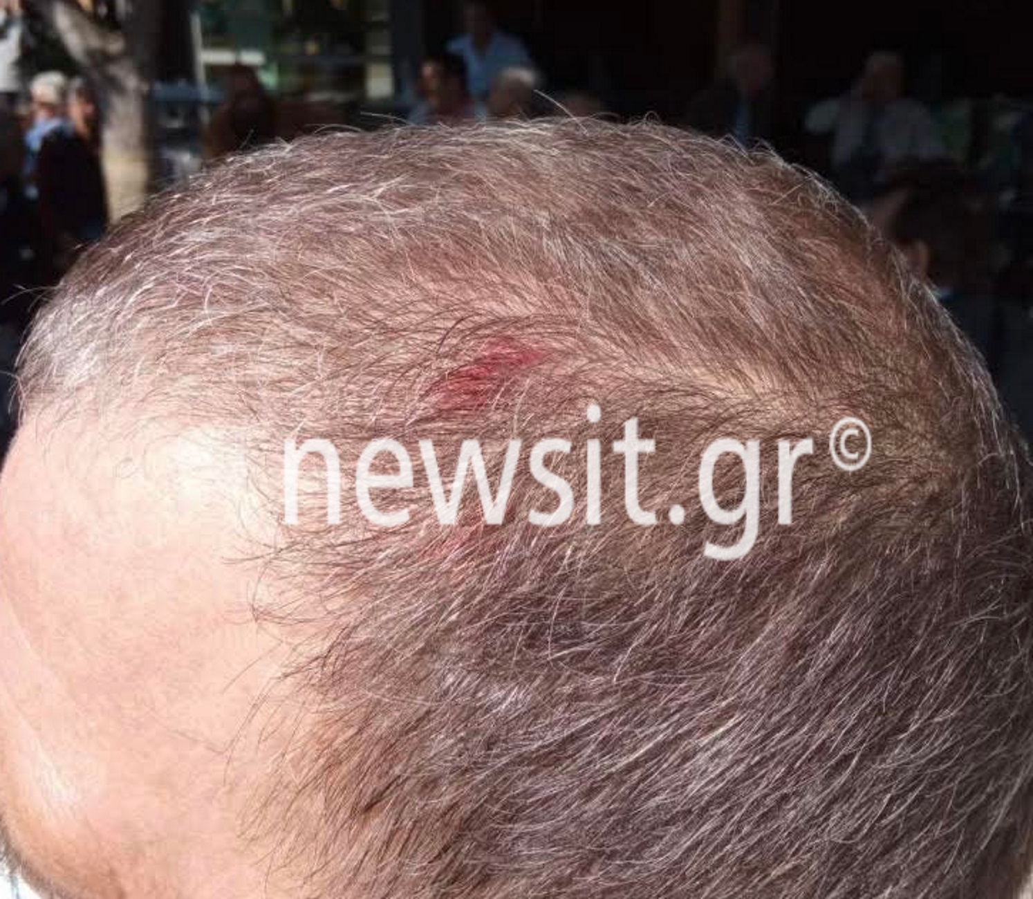 Άγρια επίθεση στη Θεσσαλονίκη σε αφισοκολλητές της ΚΝΕ