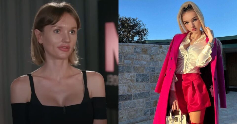 Παραμορφώθηκε από τις πλαστικές η Αλιόνα του GNTM, στα 33 της μοιάζει με  16χρονο κοριτσάκι