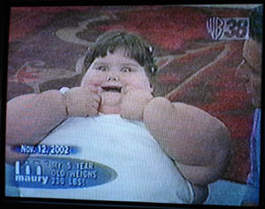 Το παχύτερο παιδί στον κόσμο αδυνάτισε 