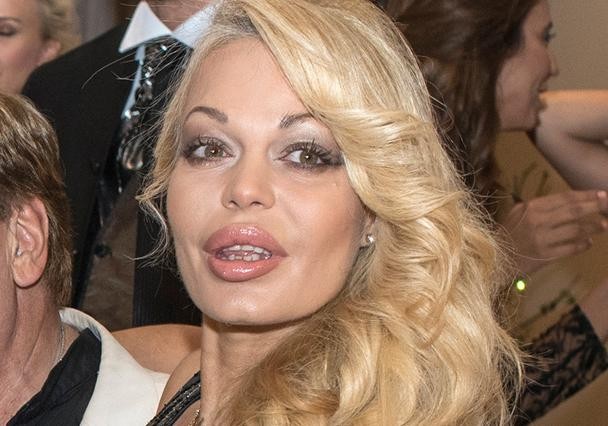 Η Τατιάνα Δράκου αγνώριστη από τις πλαστικές