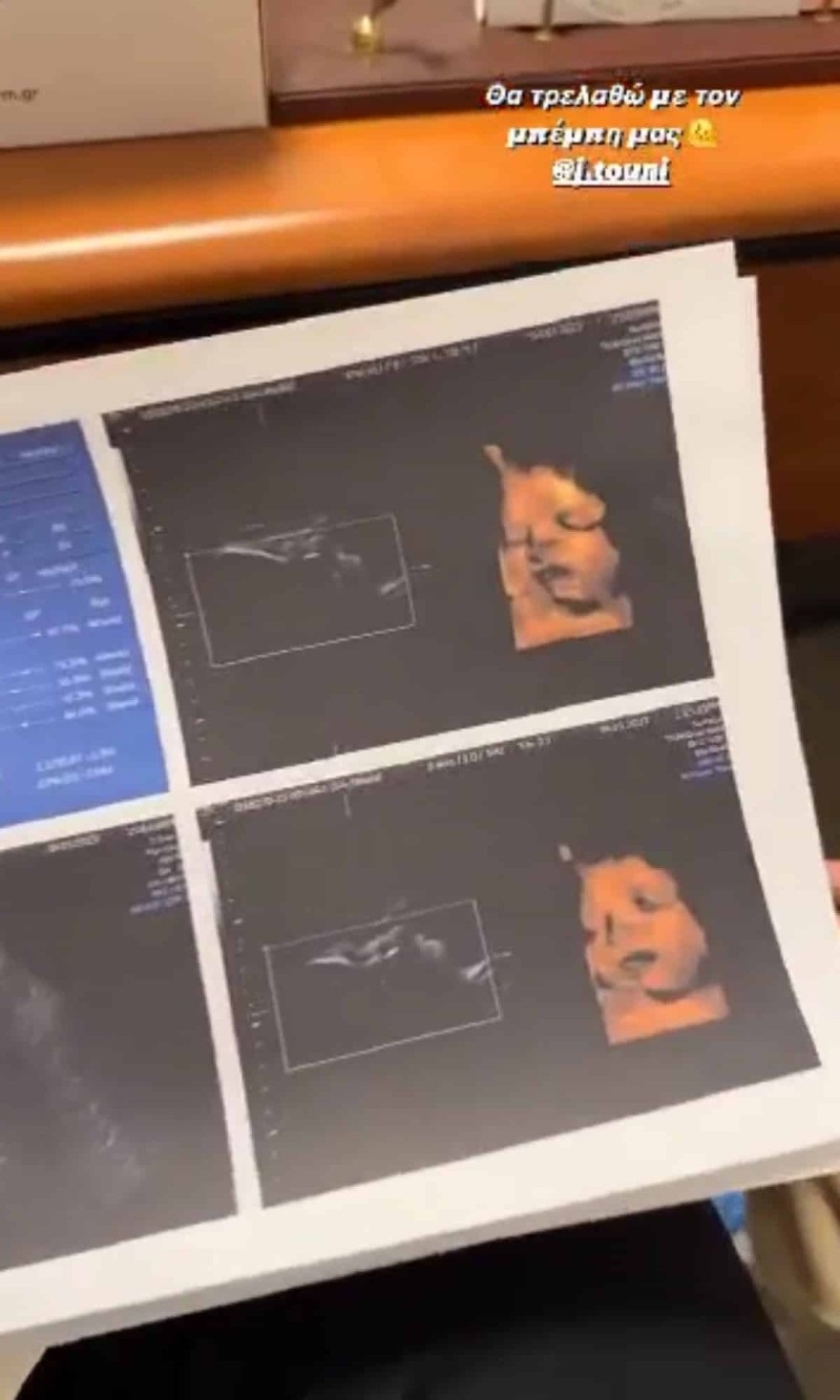 Ιωάννα Τούνη μωρό